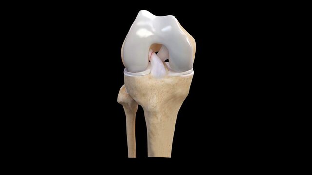 ACL Tears: Overview, video thumbnail