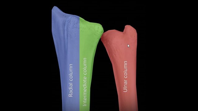 Wrist Fractures: Overview, video thumbnail