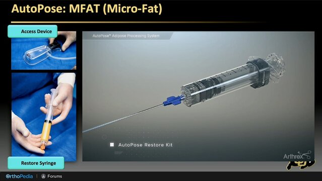 Orthobiologics: Which Cells, How to Get Them, and Where They Go, video thumbnail