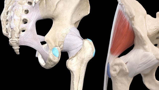 Hip Bursitis: Overview, video thumbnail