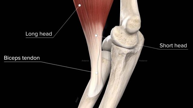Distal Biceps Tendon Tears: Overview, video thumbnail