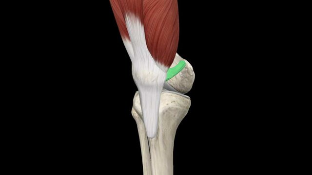 Kneecap (Patellar) Instability: Overview, video thumbnail