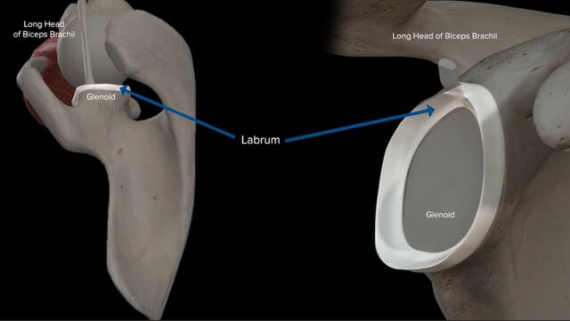 Shoulder Instability: Overview, video thumbnail
