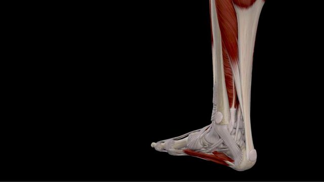 Achilles Tendon Tears: Overview, video thumbnail