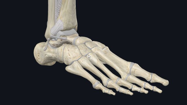 High Ankle Sprains (Syndesmotic Injuries): Overview, video thumbnail