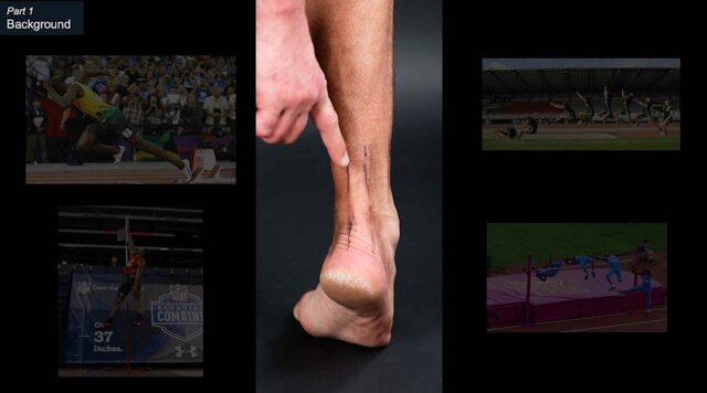 Achilles Tendon Tears: Achilles Tendon Injuries and How to Treat Them, video thumbnail