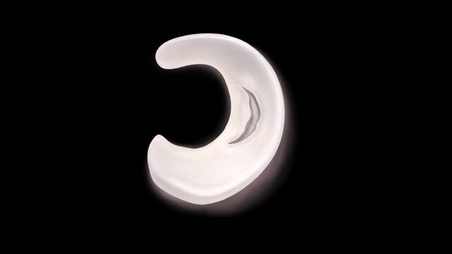 Meniscus Tears: Overview, video thumbnail
