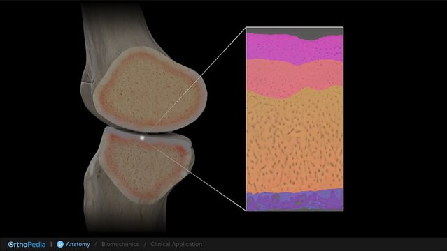 Knee Cartilage Defects: Anatomy of the Knee With Osteochondral Lesions, video thumbnail
