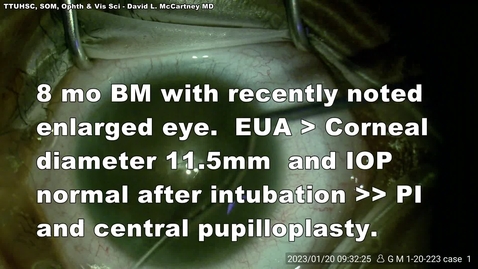 Thumbnail for 202301 Pedi Pupilloplasty &amp; PI final