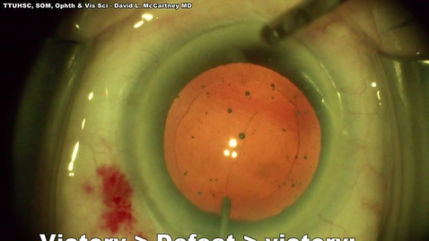 Thumbnail for DLM 202301 PC tear from damaged haptic of IOL 4K final