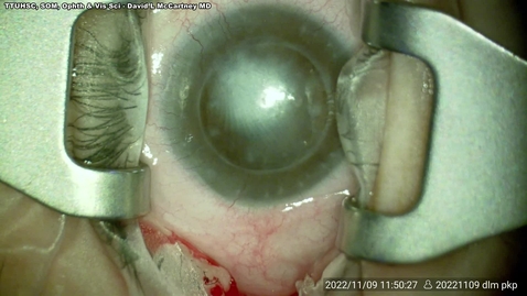 Thumbnail for 20230201 Triple proc for perf and intumescent lens.mp4