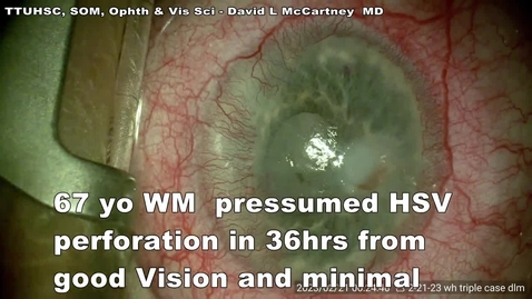 Thumbnail for DLM 20230221 Triple for perf in 36hrs HSV.mp4