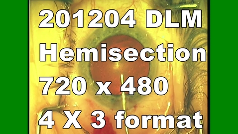Thumbnail for DLM hemi 720