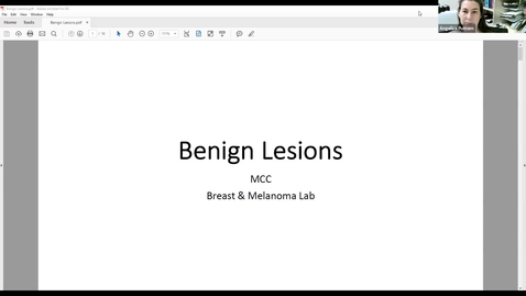 Thumbnail for MCC Labs - Breast Cancer Lab