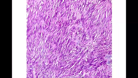 Thumbnail for M&amp;R Upper GI 2 - Stomach and Gallbladder