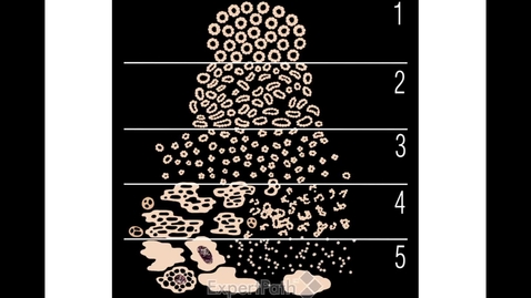 Thumbnail for Male GU - Prostate 