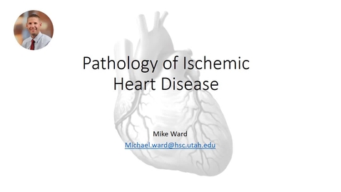 Thumbnail for MI prework video 2020