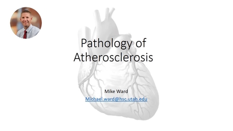 Thumbnail for Atherosclerosis prework video 2020