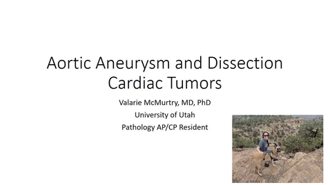 Thumbnail for entry Aneurysm, Dissection, Cardiac Tumors