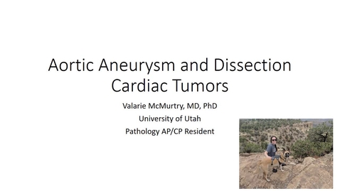 Thumbnail for Aneurysm, Dissection, Cardiac Tumors