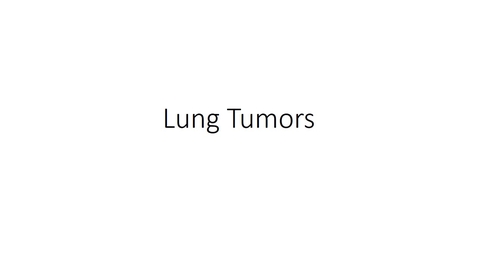 Thumbnail for entry Lung Tumors