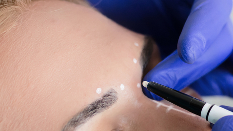 Thumbnail for Choosing Between Botox vs. Fillers