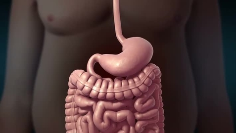 Thumbnail for Sleeve Gastrectomy