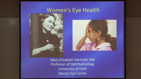 Thumbnail for Women"s eye health
