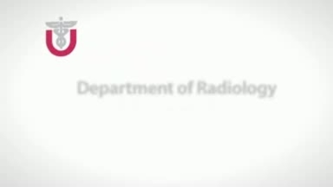 Thumbnail for Getting an MRI