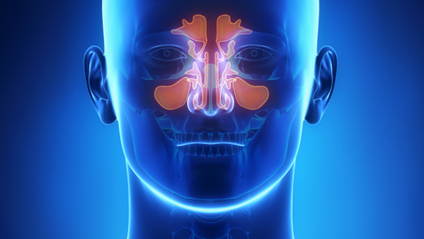 Thumbnail for What is Endoscopic Sinus Surgery?