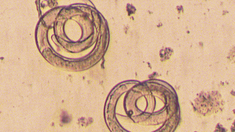 Thumbnail for Tapeworms: Easy Weight Loss Or Potentially Fatal?