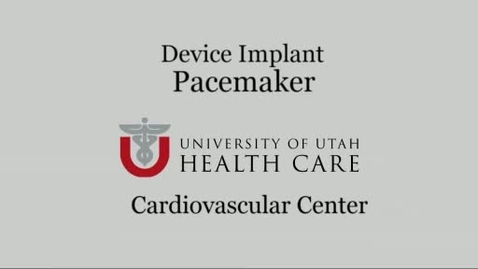 Thumbnail for Pacemaker Overview