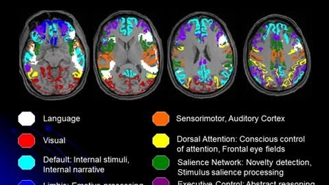 Thumbnail for entry Map of Brain Network Anatomy