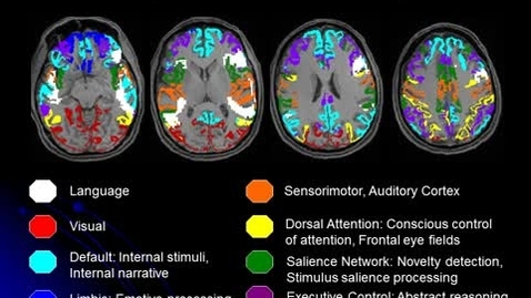 Thumbnail for Map of Brain Network Anatomy