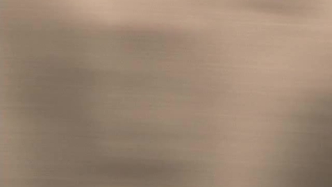 Thumbnail for Surgery in Soft Tissue Sarcoma -  - 11/02/11