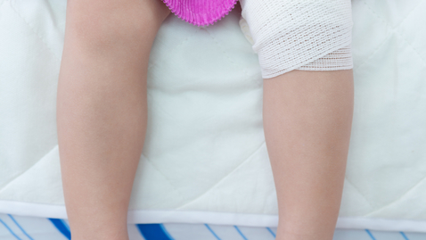 Thumbnail for The Differences Between a Child’s and Adult’s Knee Injury