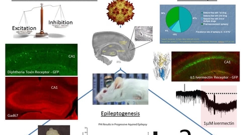 Thumbnail for entry Dudek Lab, Epilepsy