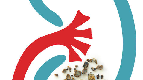 Thumbnail for Preventing Kidney Stones