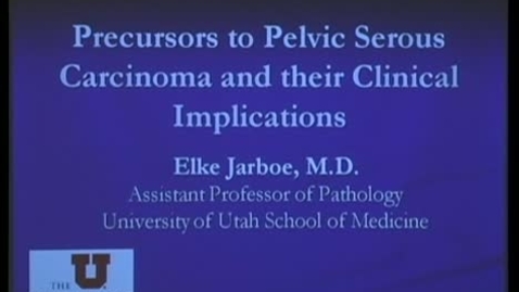 Thumbnail for Precursors to Pelvic Serous Carcinoma &amp; their Clinical Implications