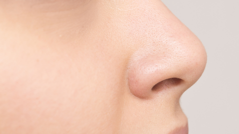 Thumbnail for What You Should Know Before Getting a Nose Job