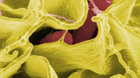 Thumbnail for Could Donor Matching Help Fecal Transplants to Work Better?