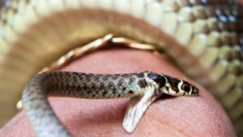 Thumbnail for ER or Not: Bit By a Non-Poisonous Snake