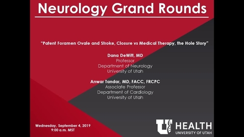 Thumbnail for Patent Foramen Ovale and Stroke, Closure vs Medical Therapy, the Hole Story