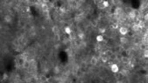 Thumbnail for 2 PHOTON MICROSCOPY OF CSD