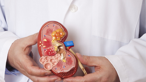 Thumbnail for How to Reduce Your Risk of Developing Another Kidney Stone