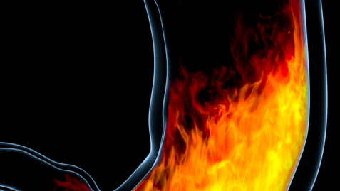 Thumbnail for Frequent Heartburn? You May Want to Visit Your Doctor