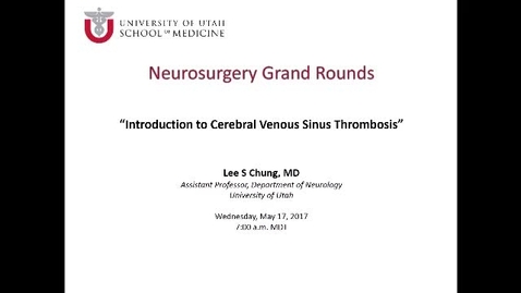 Thumbnail for Neurosurgery Grand Rounds 05-17-2017