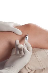 Joint Replacements Sepsis Alliance