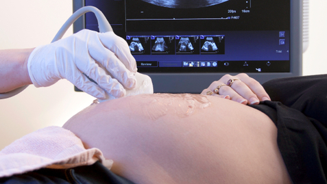 Thumbnail for Steps You Can Take to Prevent Birth Defects in Your Baby