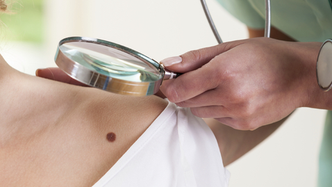 Thumbnail for Mole Crowdsourcing to Detect Skin Cancer